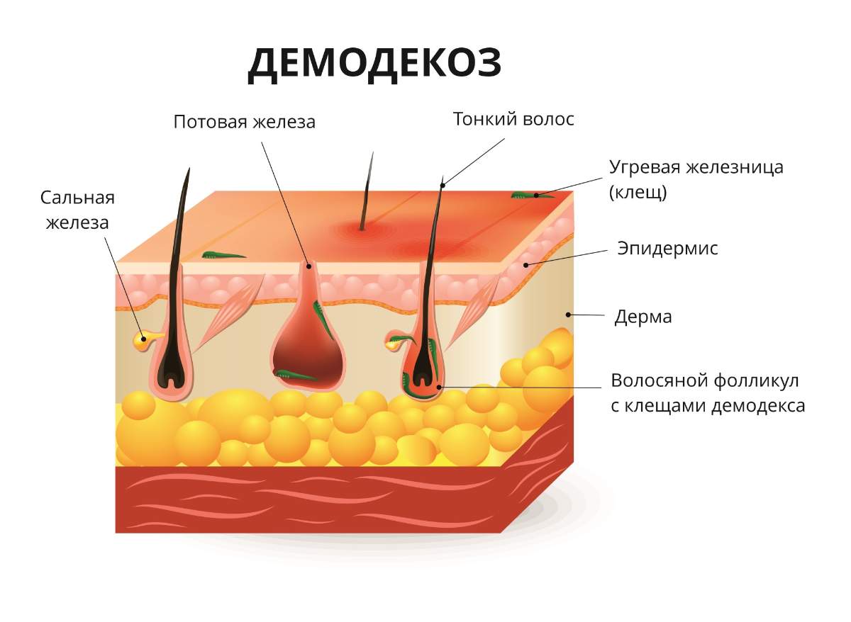 Лечение демодекоза в Хабаровске